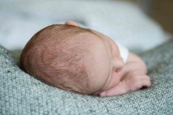 Die Entwicklung der Kopfform deines Babys - und was dabei schiefgehen kann!